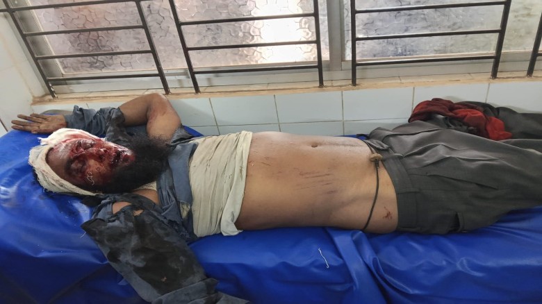 আদালতে যাওয়ার পথে সড়ক দুর্ঘটনায় কৃষকের মৃত্যু...